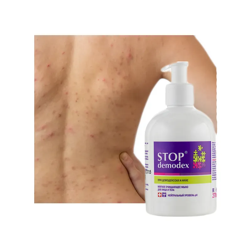 Stop Demodex  mydło do twarzy i ciała na TRĄDZIK - NUŻYCA 🩺 Laroxy.pl