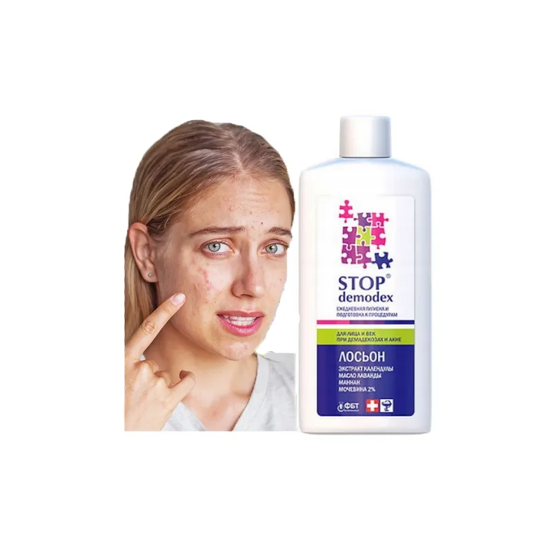 STOP Demodex Tonic Face Tonic for nausea acne blackheads - Laroxy.com