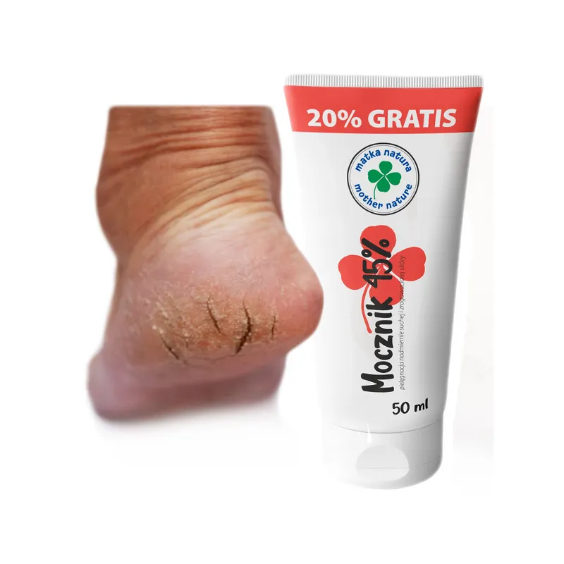 Matka Natura krem do stóp na pękające pięty zrogowacenia z MOCZNIKIEM 45% 50ml