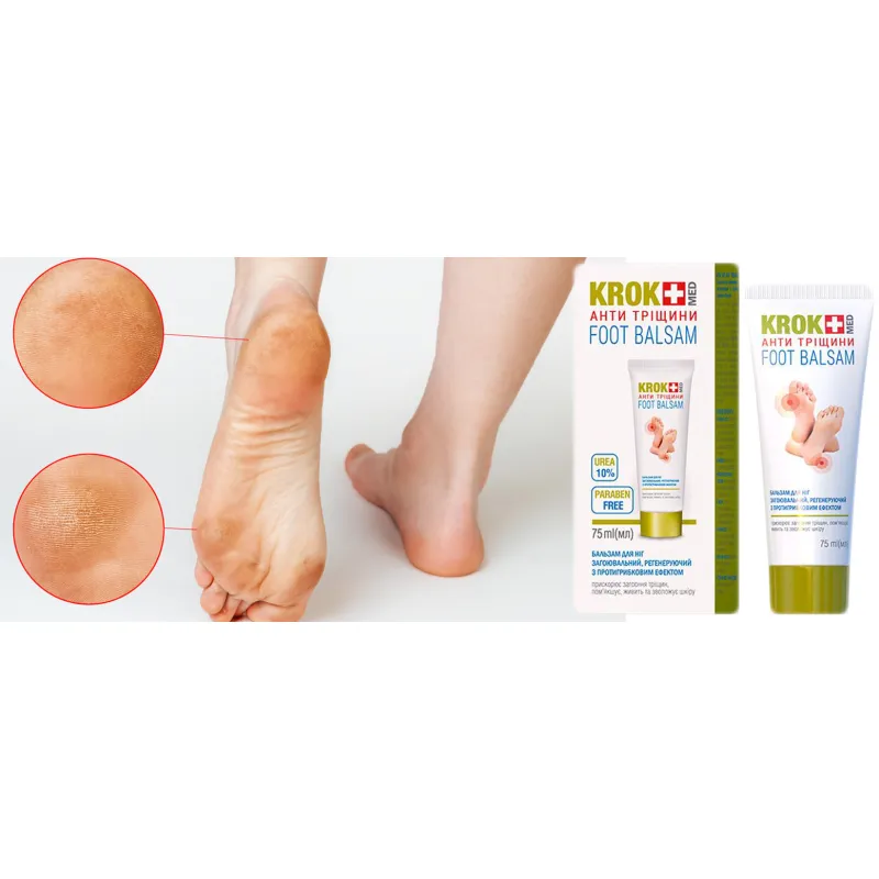Ointment for corns with root calluses on the toe foot preparation ❤️ Laroxy.pl