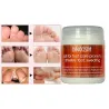 BingoSpa Salt for toenail fungus REFUSALIZATION OF HEADS ❤️ Laroxy