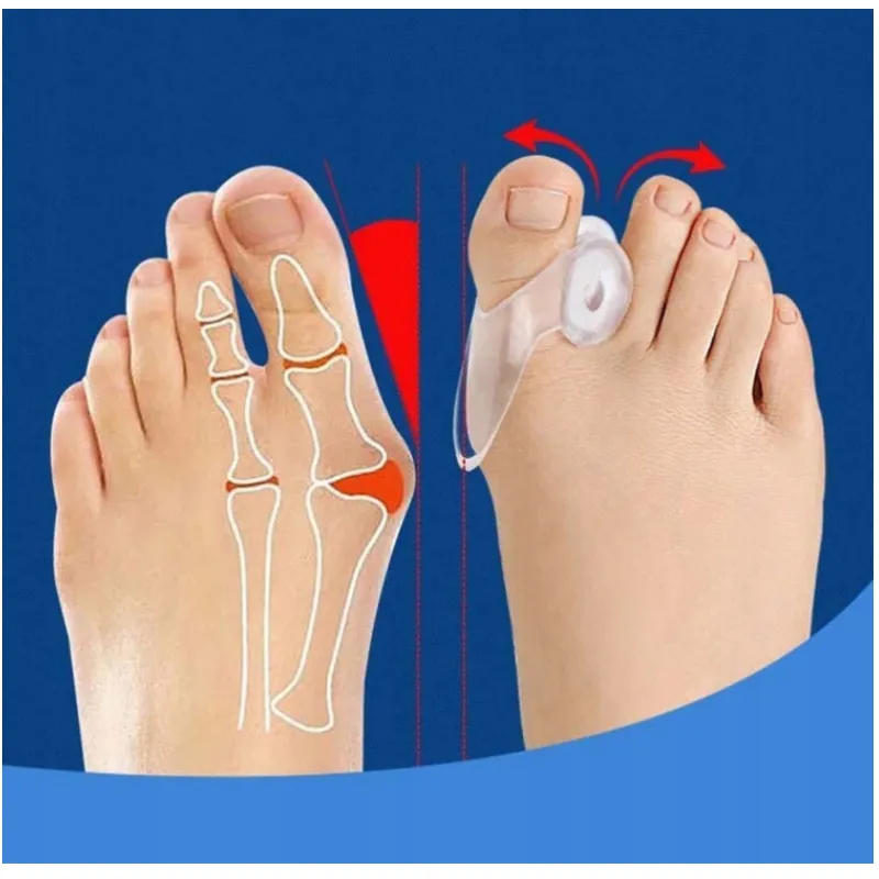 Shark Shark leaf hallux ointment + hallux pads 🦶 Laroxy