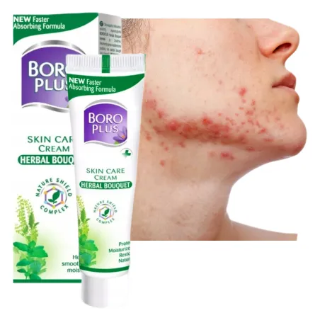 BORO HERBAL ayurvedic antiseptic acne ointment - Laroxy.com