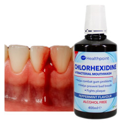 Inflammatory gum rinse with chlorhexidine 🍃 Laroxy