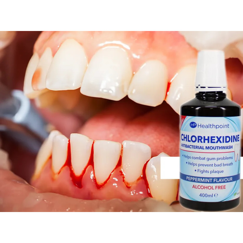 Inflammatory gum rinse with chlorhexidine 🍃 Laroxy