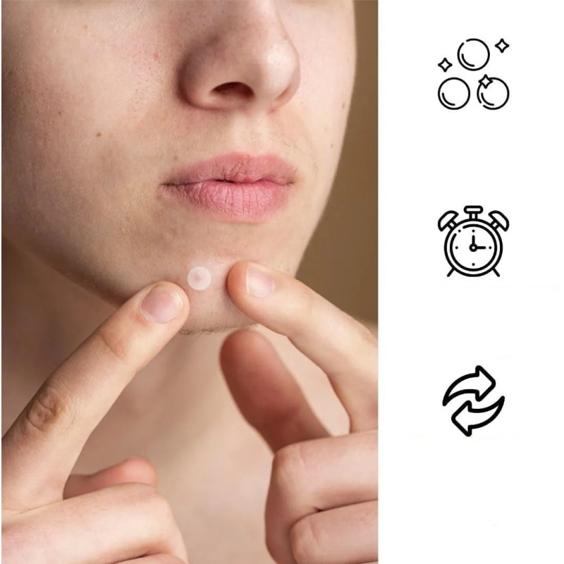 Pimple patches - spot for hydrocolloid pimples ❤️ Laroxy