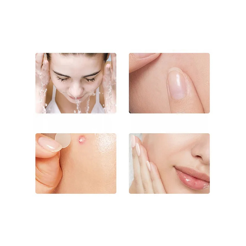 Pimple patches - spot for hydrocolloid pimples ❤️ Laroxy