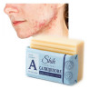 Salicylic acid soap for acne pimples - Laroxy.pl