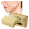 Sulphur soap for acne pimples scabies nuisance - Laroxy.pl