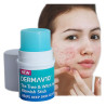 Acne cream pimples spot treatment gel ❤️ Laroxy