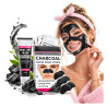 Blackheads pores mask + Patches KIT ❤️ Laroxy