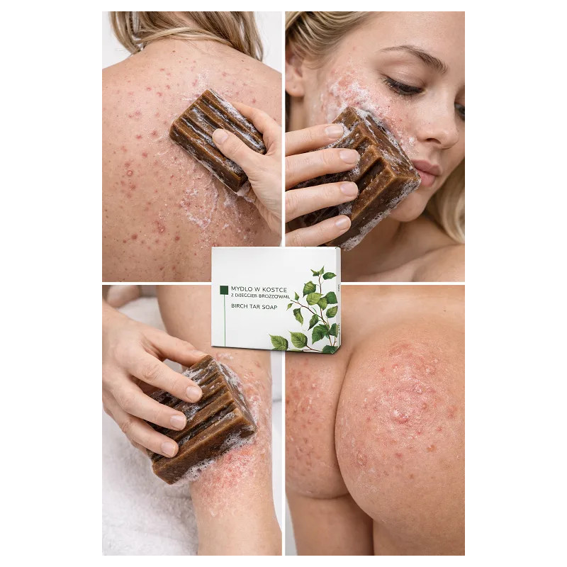 Tar soap for face and body for skin problems - Laroxy.pl