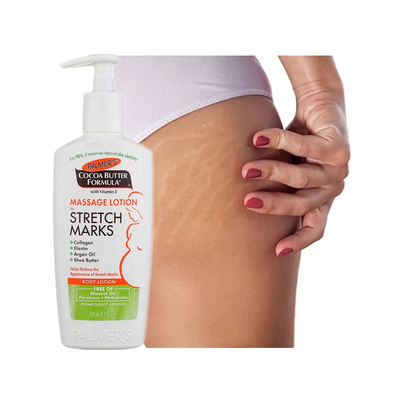 Palmers good stretch mark cream for teens ❤️ Laroxy.co.uk
